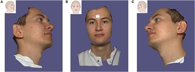 Validation of the Portable Next-Generation VECTRA H2 3D Imaging System for Periocular Anthropometry